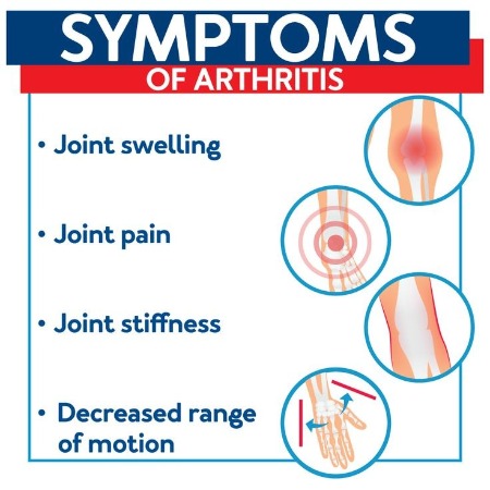 arthritis-image