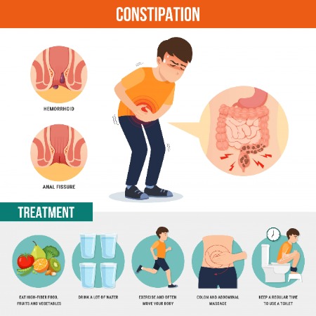 constipation-image