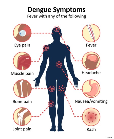 DENGUE